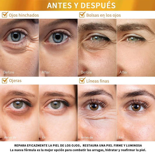 60 Parches Exclusivos Para Ojos | Elimina Ojeras y Recupera una Mirada Fresca!